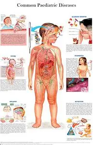 Common paediatric diseases: Quick reference guide