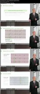 Electrocardiogram (ECG) Interpretation