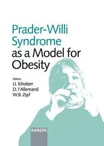 Prader-Willi Syndrome as a Model for Obesity