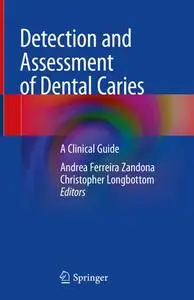 Detection and Assessment of Dental Caries: A Clinical Guide (Repost)