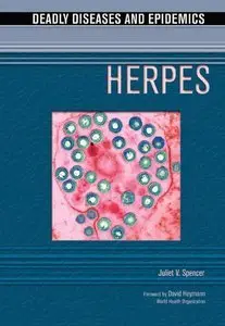 Juliet V. Spencer - Herpes (Deadly Diseases & Epidemics) [Repost]