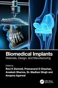 Biomedical Implants: Materials, Design, and Manufacturing