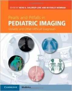 Pearls and Pitfalls in Pediatric Imaging: Variants and Other Difficult Diagnoses