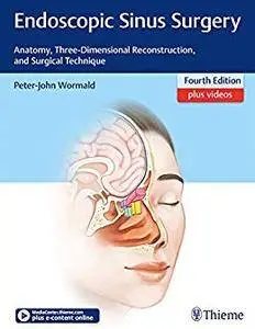 Endoscopic Sinus Surgery, 4th Edition