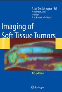 Imaging of Soft Tissue Tumors