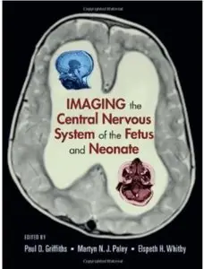 Imaging the Central Nervous System of the Fetus and Neonate