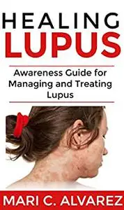 Healing Lupus: Awareness Guide for Managing and Treating Lupus