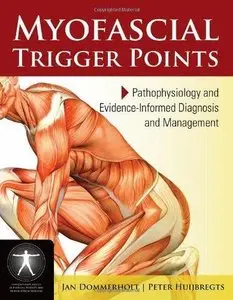 Myofascial Trigger Points: Pathophysiology and Evidence-informed Diagnosis and Management (Repost)