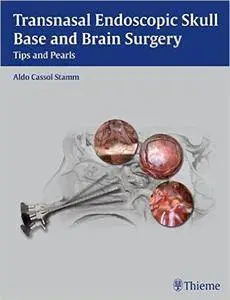 Transnasal Endoscopic Skull Base and Brain Surgery: Tips and Pearls