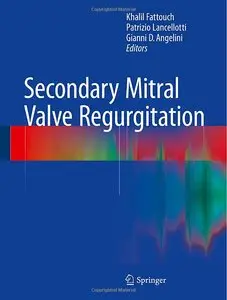 Secondary Mitral Valve Regurgitation