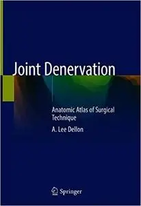 Joint Denervation: An Atlas of Surgical Techniques