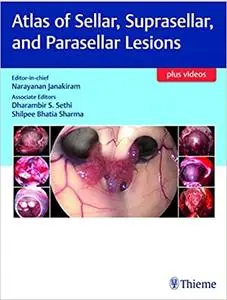 Atlas of Sellar, Suprasellar and Parasellar Lesions