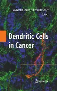 Dendritic Cells in Cancer