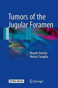 Tumors of the Jugular Foramen