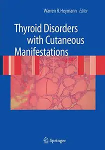 Thyroid Disorders with Cutaneous Manifestations (Repost)