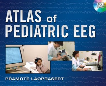 Atlas of Pediatric EEG (Atlas Series) by Pramote Laoprasert [Repost]