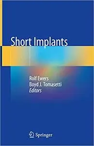 Short Implants