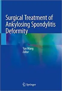 Surgical Treatment of Ankylosing Spondylitis Deformity (repost)