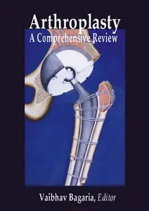 "Arthroplasty: A Comprehensive Review" ed. by Vaibhav Bagaria