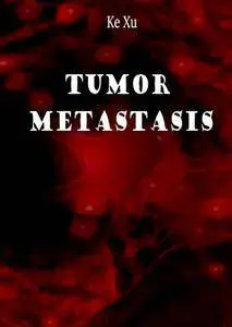"Tumor Metastasis" ed. by Ke Xu