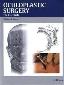 Oculoplastic Surgery: The Essentials