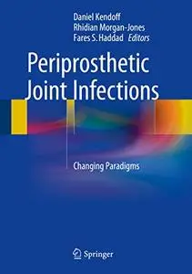 Periprosthetic Joint Infections: Changing Paradigms (Repost)