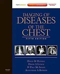 Imaging of Diseases of the Chest: Expert Consult - Online and Print, 5th edition (repost)