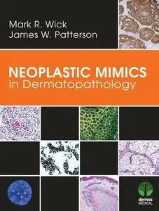 Neoplastic Mimics in Dermatopathology (repost)