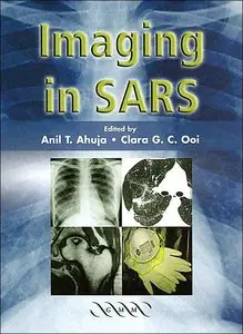 Imaging in SARS (Repost)