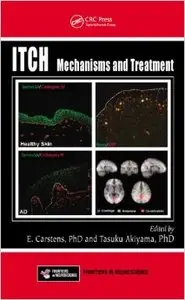 Itch: Mechanisms and Treatment (repost)