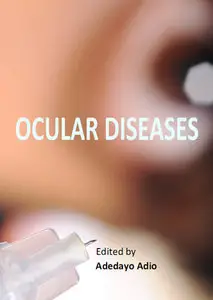 "Ocular Diseases" ed. by Adedayo Adio