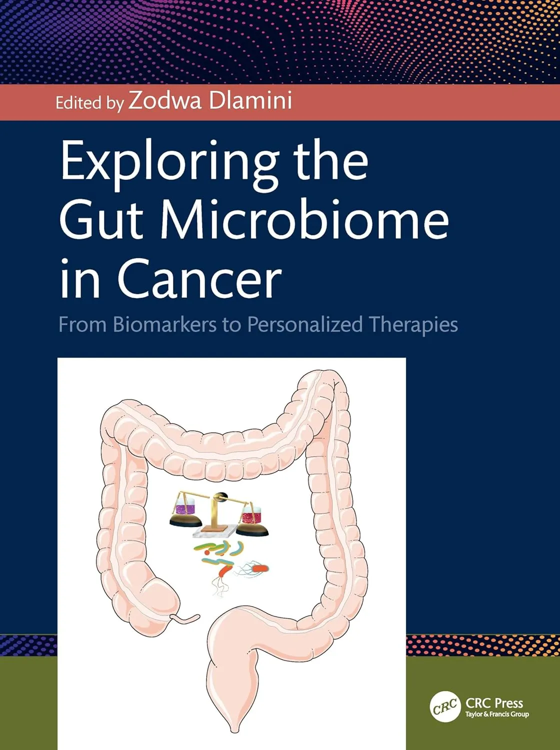 Exploring the Gut Microbiome in Cancer: From Biomarkers to Personalized Therapies