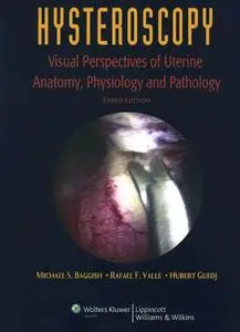 Hysteroscopy: Visual Perspectives of Uterine Anatomy, Physiology and Pathology