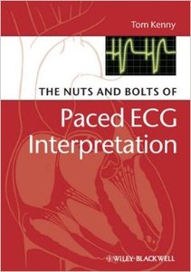 The Nuts and Bolts of Paced ECG Interpretation