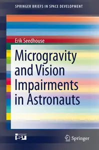 Microgravity and Vision Impairments in Astronauts (Repost)