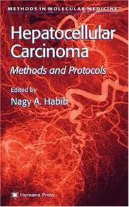 Hepatocellular Carcinoma: Methods and Protocols