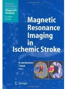 Magnetic Resonance Imaging in Ischemic Stroke [Repost]