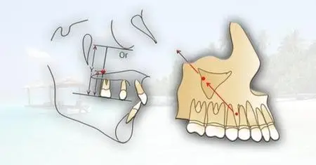 Introduction to Orthodontics. Patient Examination.