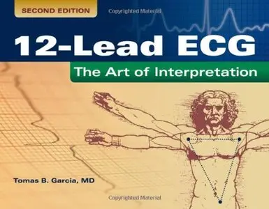 12-lead ECG: The Art of Interpretation, 2nd edition (repost)