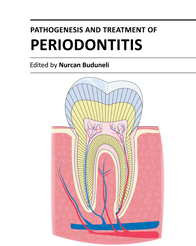 Pathogenesis and Treatment of Periodontitis