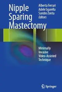 Nipple Sparing Mastectomy: Minimally Invasive Video-Assisted Technique (repost)