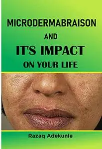 MICRODERMABRASION AND IT'S IMPACT ON YOUR LIFE
