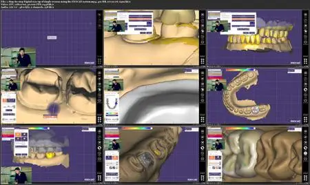 Digital Dentistry, CAD-CAM and Decision-Making