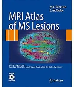 MRI Atlas of MS Lesions