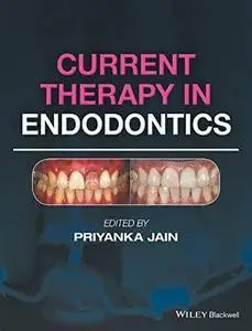 Current Therapy in Endodontics (repost)