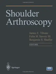 Shoulder Arthroscopy