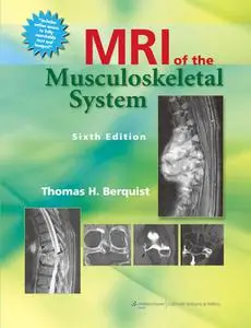 MRI of the Musculoskeletal System, 6th Edition