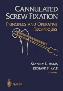 Cannulated Screw Fixation: Principles and Operative Techniques