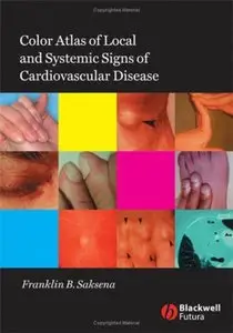 Color Atlas of Local and Systemic Signs of Cardiovascular Disease