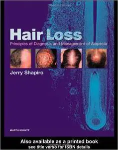 Hair Loss: Principles of Diagnosis and Management of Alopecia